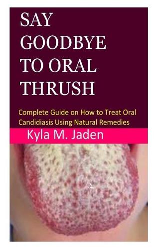 Say Goodbye to Oral Thrush by Kyla M Jaden Waterstones