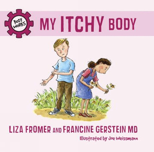 My Itchy Body (Hardback)