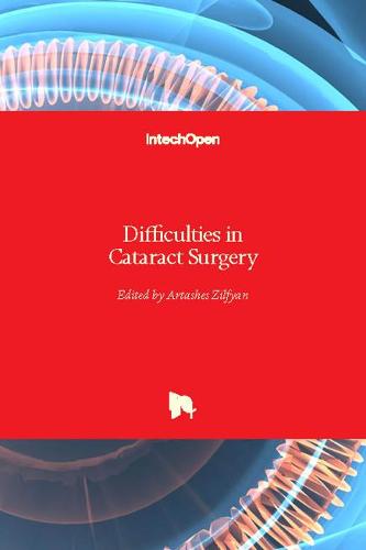 Difficulties in Cataract Surgery (Hardback)
