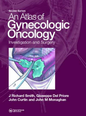 Atlas of Gynecologic Oncology (Hardback)