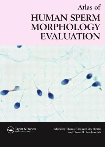 Atlas of Human Sperm Morphology Evaluation (Hardback)