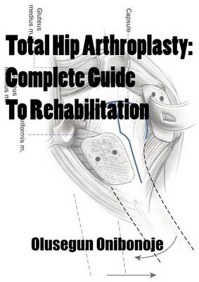 Total Hip Arthroplasty: Complete Guide To Rehabilitation (Paperback)