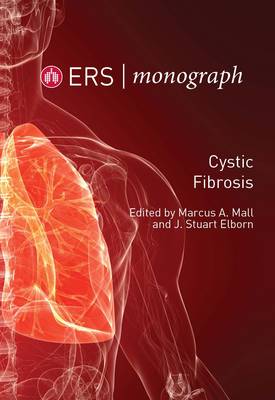 Cystic Fibrosis - ERS Monograph 64 (Paperback)