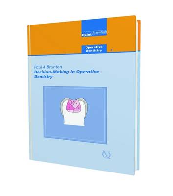 Decision-making in Operative Dentistry - Quintessentials: Operative Dentistry v. 1 (Hardback)