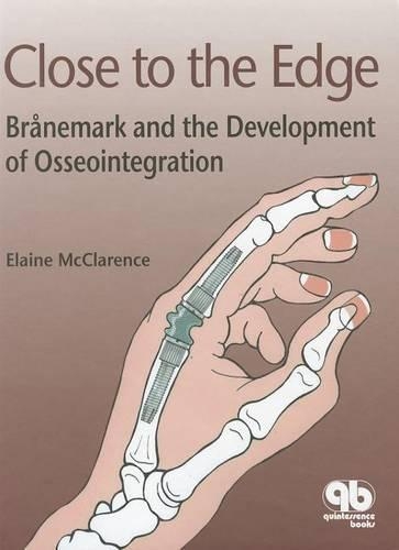 Close to the Edge: Branemark and the Development of Osseointegration (Hardback)