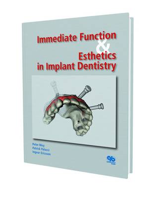 Immediate Function and Esthetic in Implant Dentistry (Hardback)