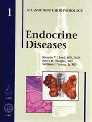 Endocrine Diseases - Atlas of Non-Tumor Pathology, Series 1, (Hardback)