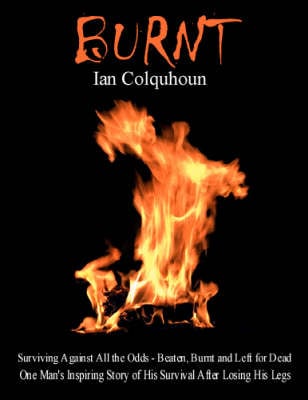 Burnt: Surviving Against All the Odds - Beaten, Burnt and Left for Dead. One Man's Inspiring Story of His Survival After Losing His Legs (Paperback)