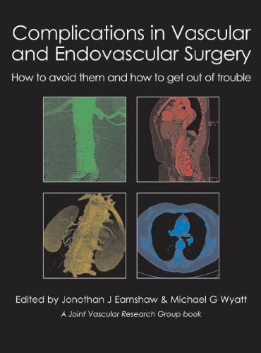 Complications in Vascular & Endovascular Surgery: How to Avoid Them & How to Get Out of Trouble (Hardback)