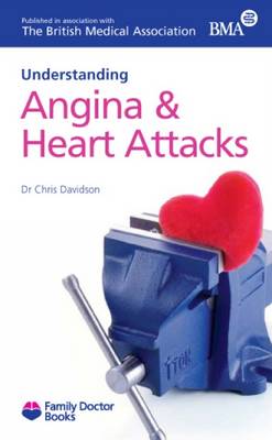 Understanding Angina & Heart Attacks - Family Doctor Books (Paperback)