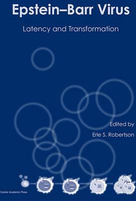 Epstein-Barr Virus: Latency and Transformation (Hardback)