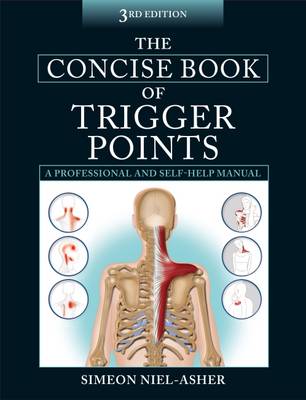 The Concise Book of Trigger Points (Paperback)