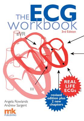 The ECG Workbook (Paperback)