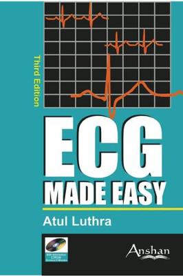 ECG Made Easy - Made Easy (Paperback)