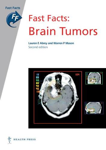 Fast Facts: Brain Tumors (Paperback)