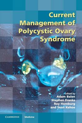 Current Management of Polycystic Ovary Syndrome - Royal College of Obstetricians and Gynaecologists Study Group (Paperback)