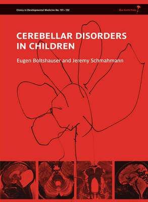 Cerebellar Disorders in Children - Clinics in Developmental Medicine (Hardback)