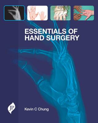 Essentials of Hand Surgery (Hardback)