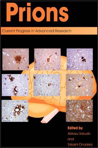 Prions: Current Progress in Advanced Research (Hardback)