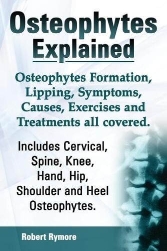Osteophytes Explained. Osteophytes Formation, Lipping, Symptoms, Causes, Exercises and Treatments All Covered. Includes Cervical, Spine, Knee, Hand, Hip, Shoulder and Heel Osteophytes. (Paperback)