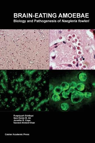 Brain-Eating Amoebae: Biology and Pathogenesis of Naegleria Fowleri (Paperback)