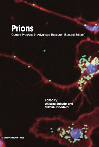 Prions: Current Progress in Advanced Research (Paperback)