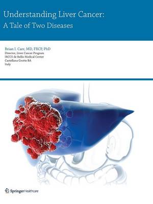 Understanding Liver Cancer: A Tale of Two Diseases (Paperback)