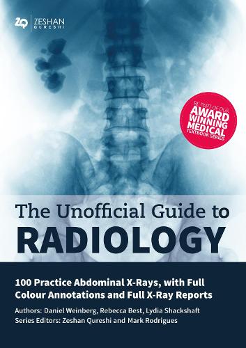 Unofficial Guide to Radiology: 100 Practice Abdominal X Rays with Full Colour Annotations and Full X Ray Reports - Unofficial Guides (Paperback)
