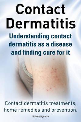 Contact Dermatitis. Contact Dermatitis Treatments, Home Remedies and Prevention. Understanding Contact Dermatitis as a Disease and Finding Cure for It (Paperback)