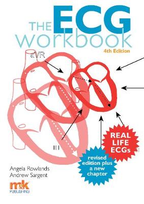 The ECG Workbook (Paperback)