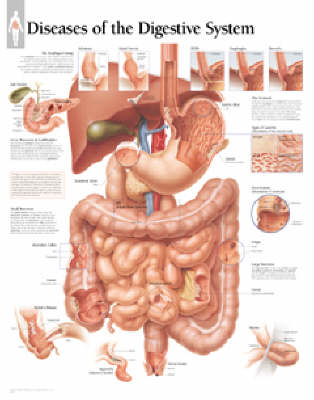 Diseases of the Digestive System Paper Poster (Poster)