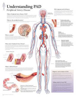 Understanding PAD Paper Poster (Poster)