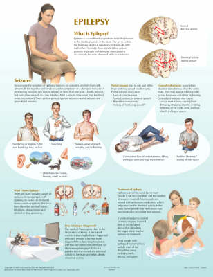 Epilepsy Chart - Netter Charts (Poster)