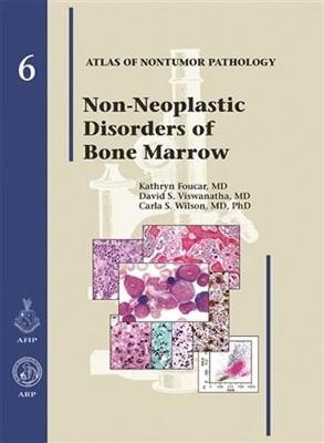 Non-Neoplastic Diseases of Bone Marrow - Atlas of Non-Tumor Pathology, Series 1, (Hardback)
