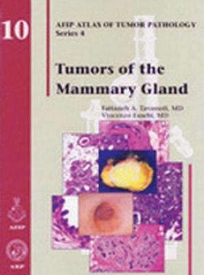 Tumors of the Mammary Gland - Atlas of Tumor Pathology, Series 4, (Hardback)