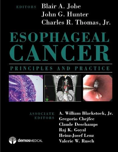 Esophageal Cancer: Principles and Practice (Hardback)