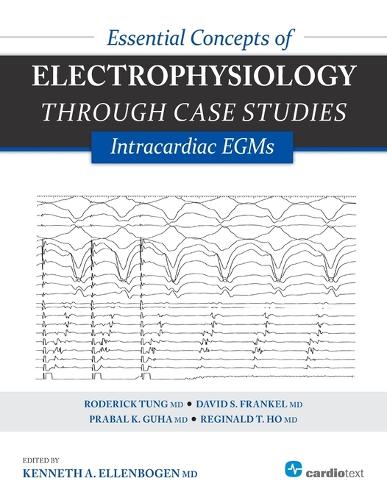 Essential Concepts of Electrophysiology Through Case Studies: Intracardiac EGMs (Paperback)