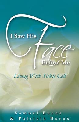I Saw His Face Before Me - Living with Sickle Cell Anemia (Paperback)