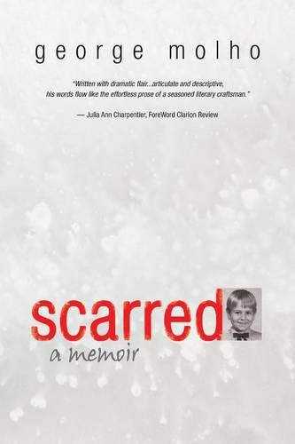 Scarred: A Memoir (Paperback)