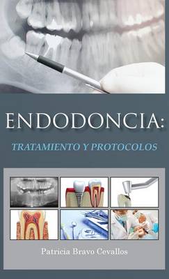 Endodoncia (Hardback)