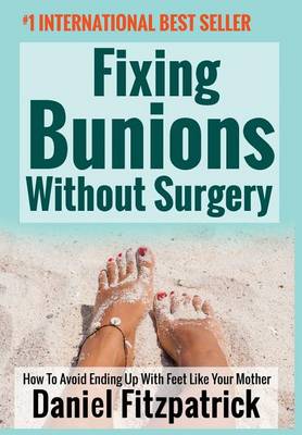 Fixing Bunions Without Surgery: How To Avoid Ending Up With Feet Like Your Mother (Hardback)