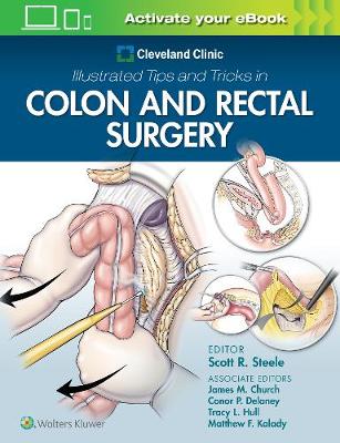 Cleveland Clinic Illustrated Tips and Tricks in Colon and Rectal Surgery (Paperback)