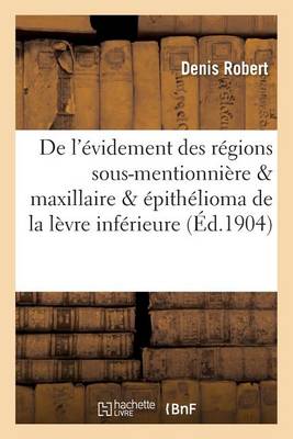 de L'Evidement Des Regions Sous-Mentionniere & Maxillaire Dans L'Epithelioma de La Levre Inferieure - Sciences (Paperback)