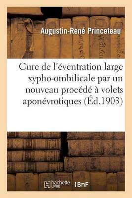 Cure Radicale de l'�ventration Large Xypho-Ombilicale Par Un Nouveau Proc�d� � Volets Apon�vrotiques - Sciences (Paperback)