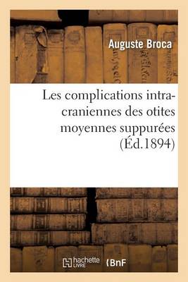 Les Complications Intra-Craniennes Des Otites Moyennes Suppur es - Sciences (Paperback)