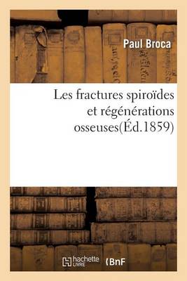 Les Fractures Spiro�des Et R�g�n�rations Osseuses - Sciences (Paperback)