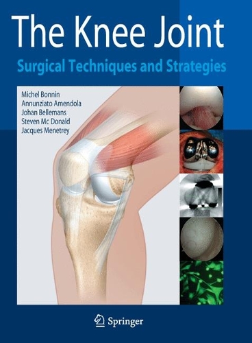 The Knee Joint: Surgical Techniques and Strategies (Hardback)