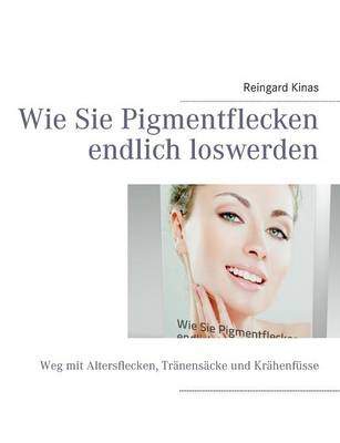 Wie Sie Pigmentflecken Endlich Loswerden (Paperback)