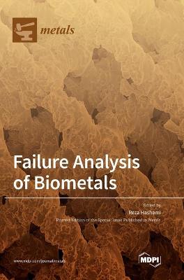 Failure Analysis of Biometals (Hardback)