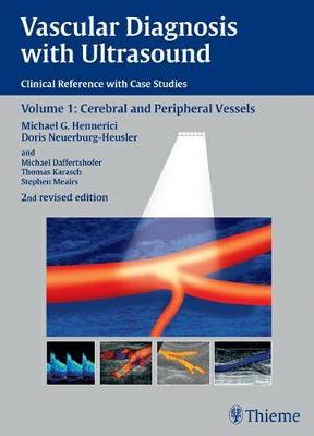 Vascular Diagnosis with Ultrasound: Clinical Reference with Case Studies Volume 1: Cerebral and Peripheral Vessels (Hardback)